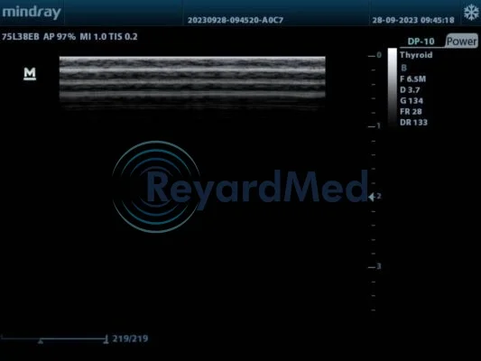 MINDRAY 75L38EB Linear Probe