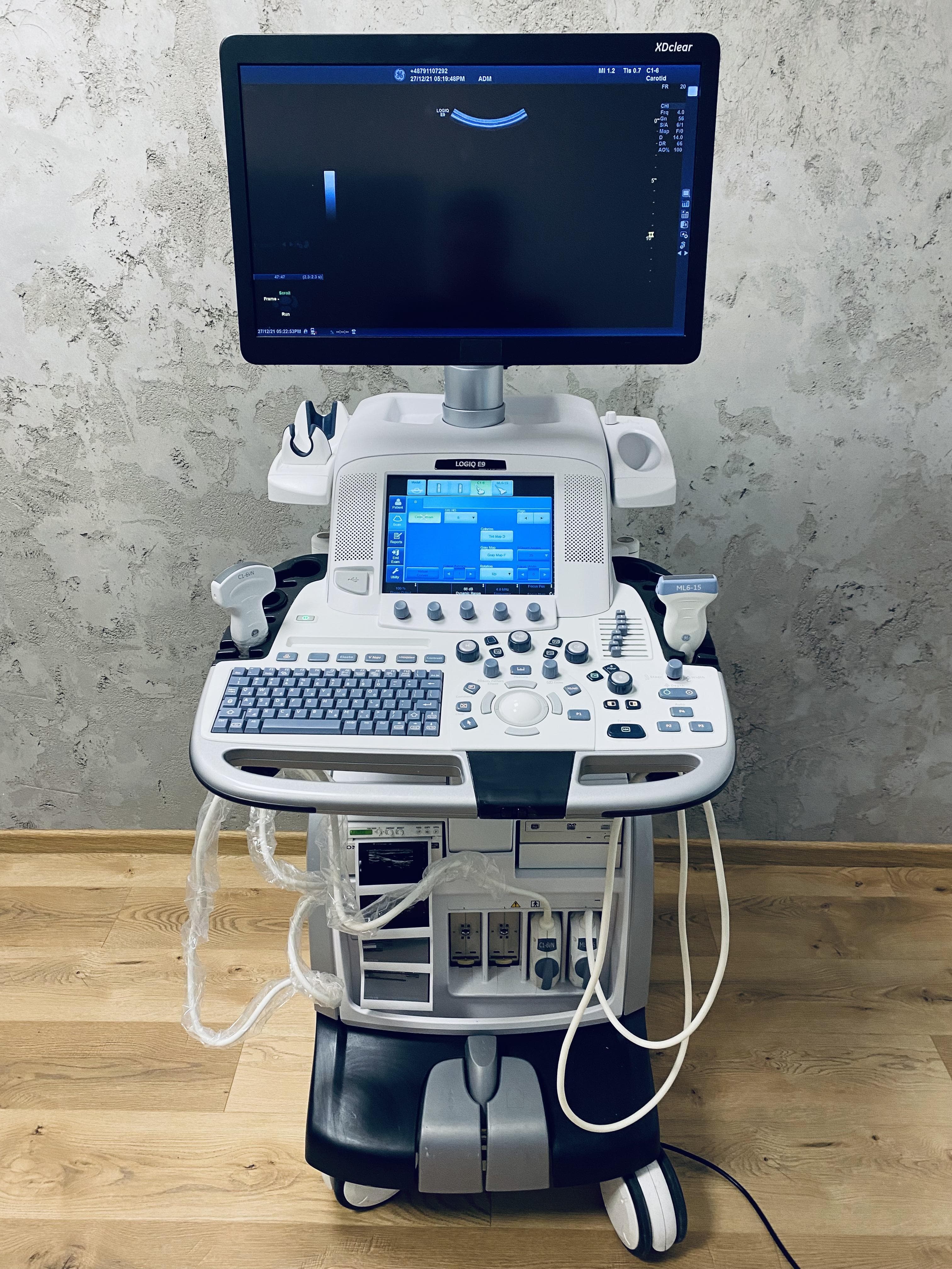 GE Logiq E9 Ultrasound Machine