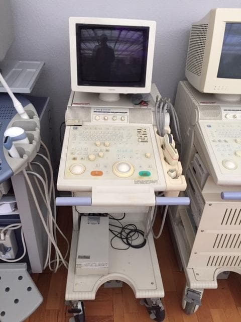TOSHIBA ECCOCEE (SSA-340A) Ultrasound Machine