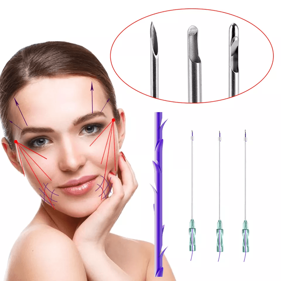 TRUGLYDE FAST 2.0 / 3.0 Suture thread