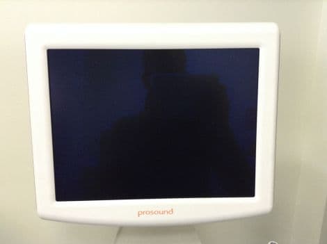 For Sale ALOKA Prosound ALPHA6 Monitor Ultrasound General Parts P/N IPF-1503