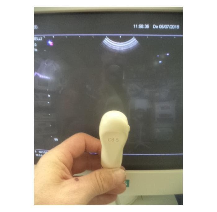 PHILIPS C8-5 Micro Convex Probe