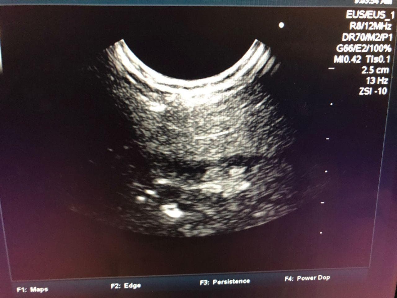 FUJIFILM EG-530UT2 Ultrasound gastroscope
