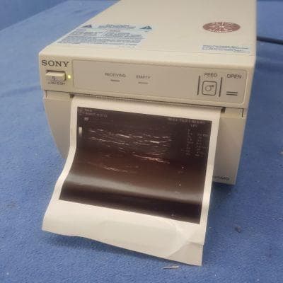 SONY UP-D895MD Ultrasound Printer