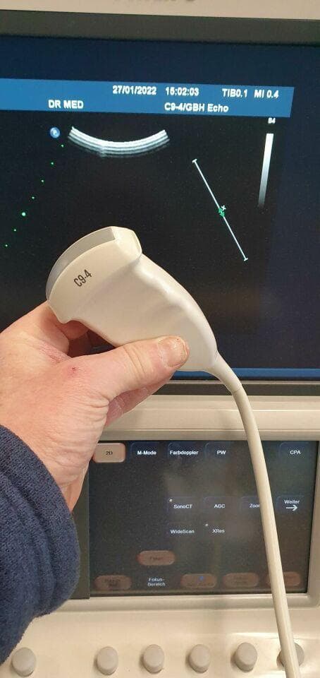PHILIPS C9-4 Convex Probe