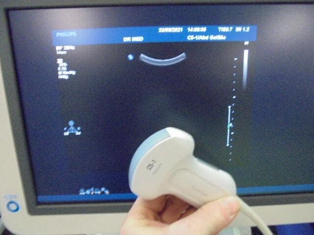 PHILIPS C5-1 Convex Probe