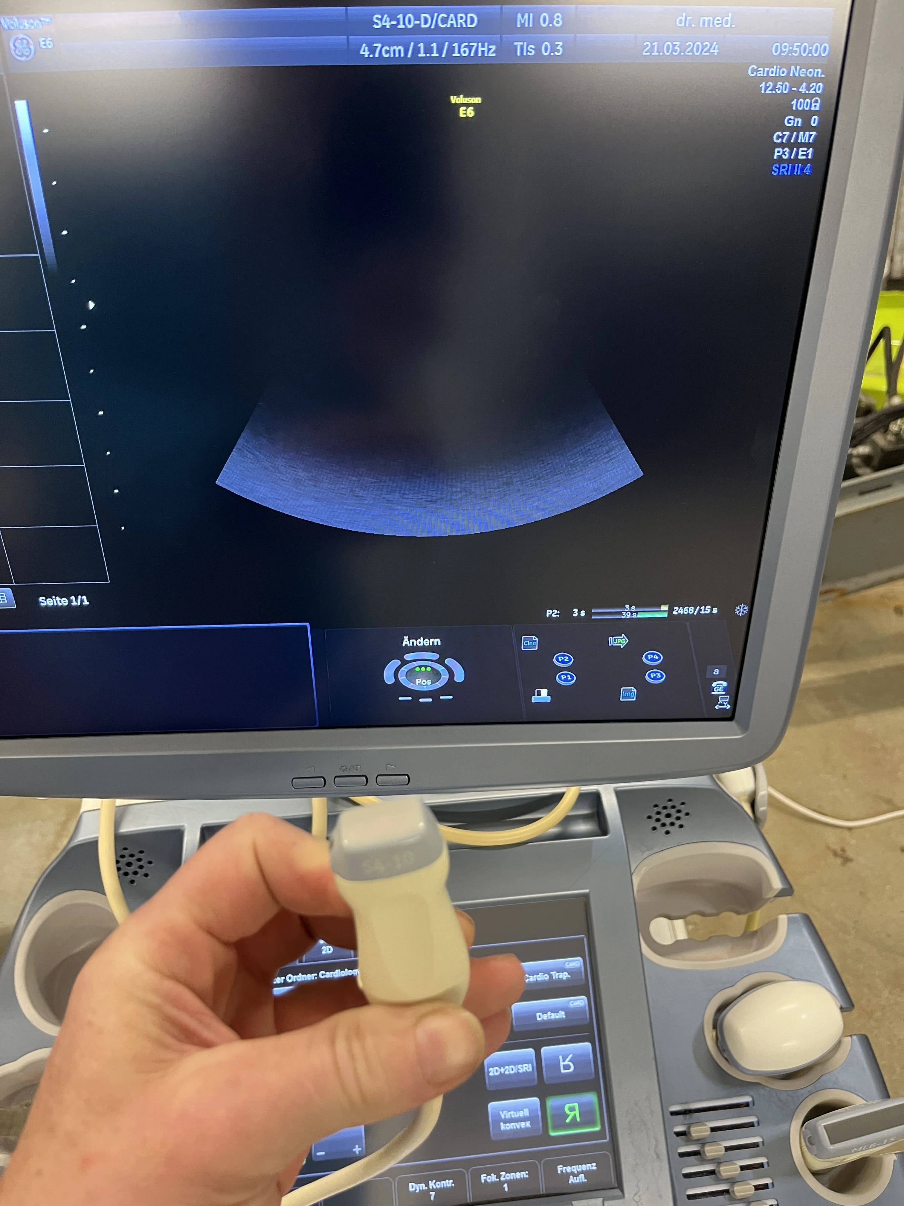 GE S4-10-D Cardiac Probe