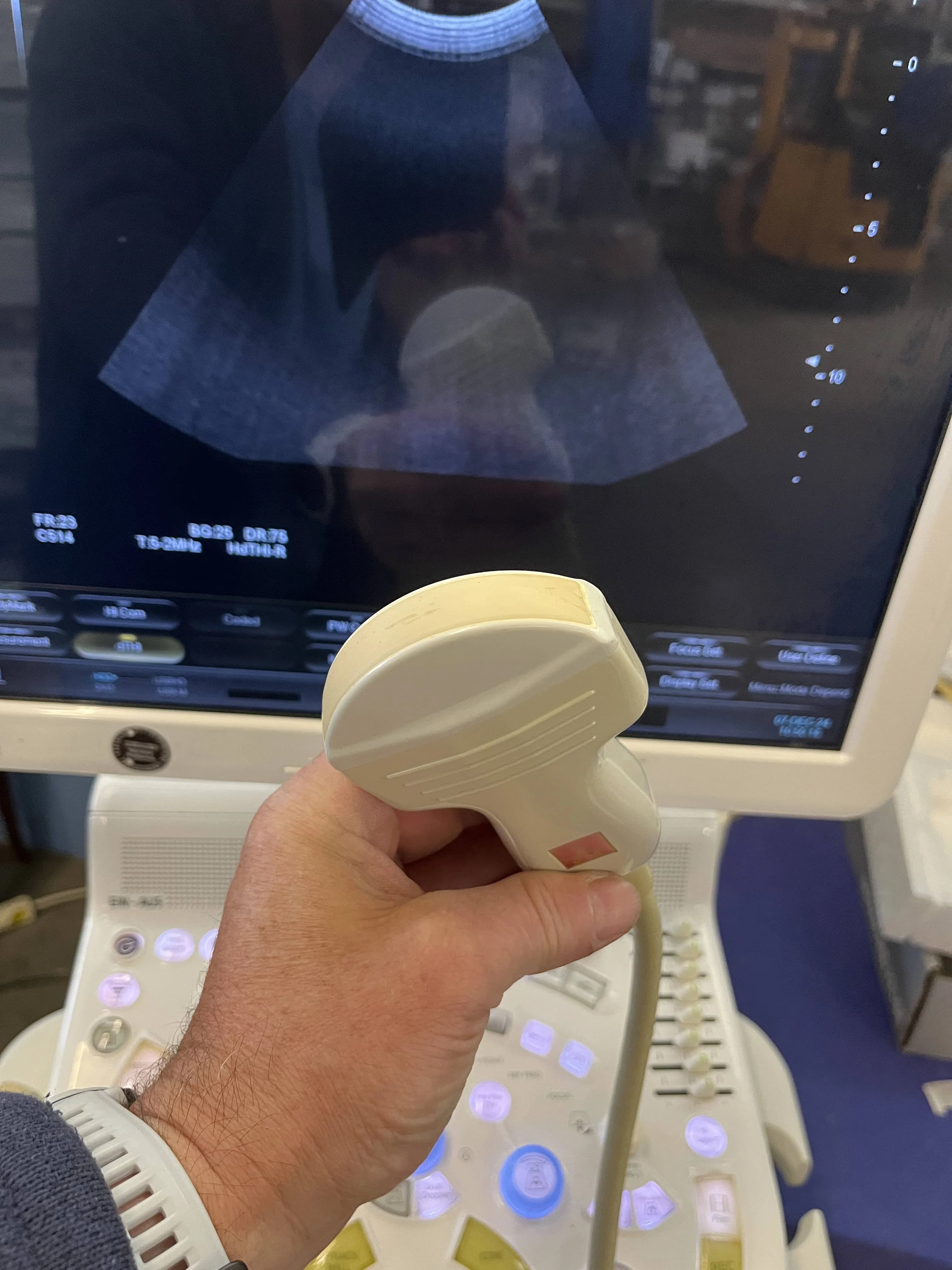 HITACHI EUP-C514 Convex Probe