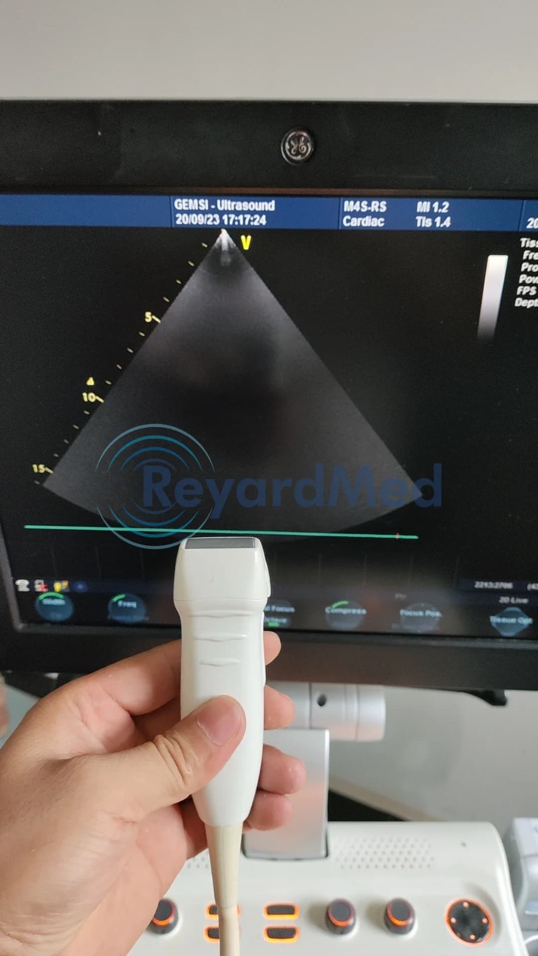GE M4S-RS Cardiac Probe