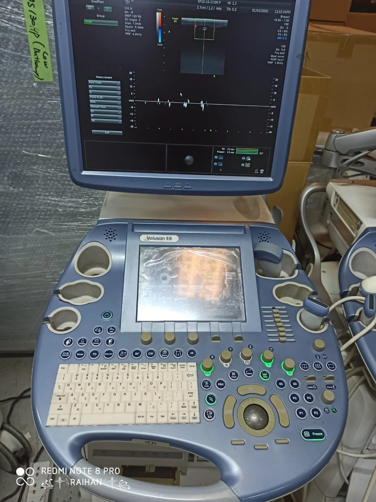 GE Voluson E8 Ultrasound Machine