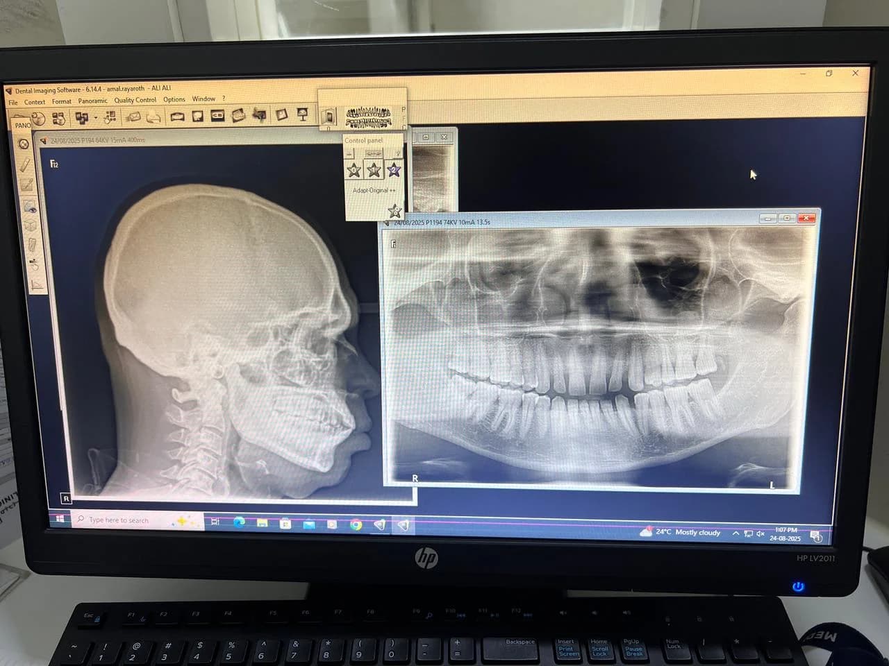 CARESTREAM CS 9000 Dental X-ray Machine