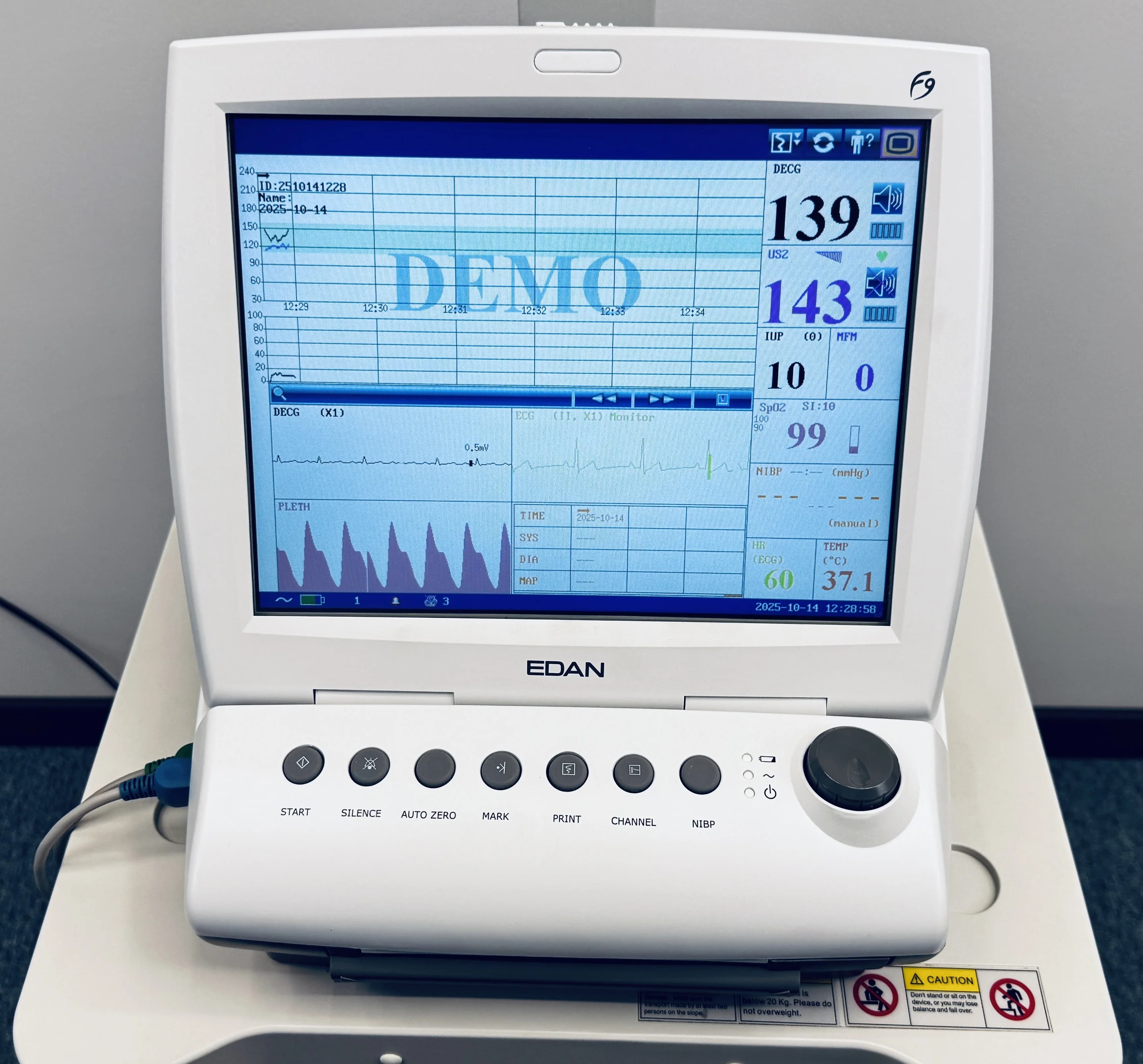 EDAN F9 Fetal Monitor