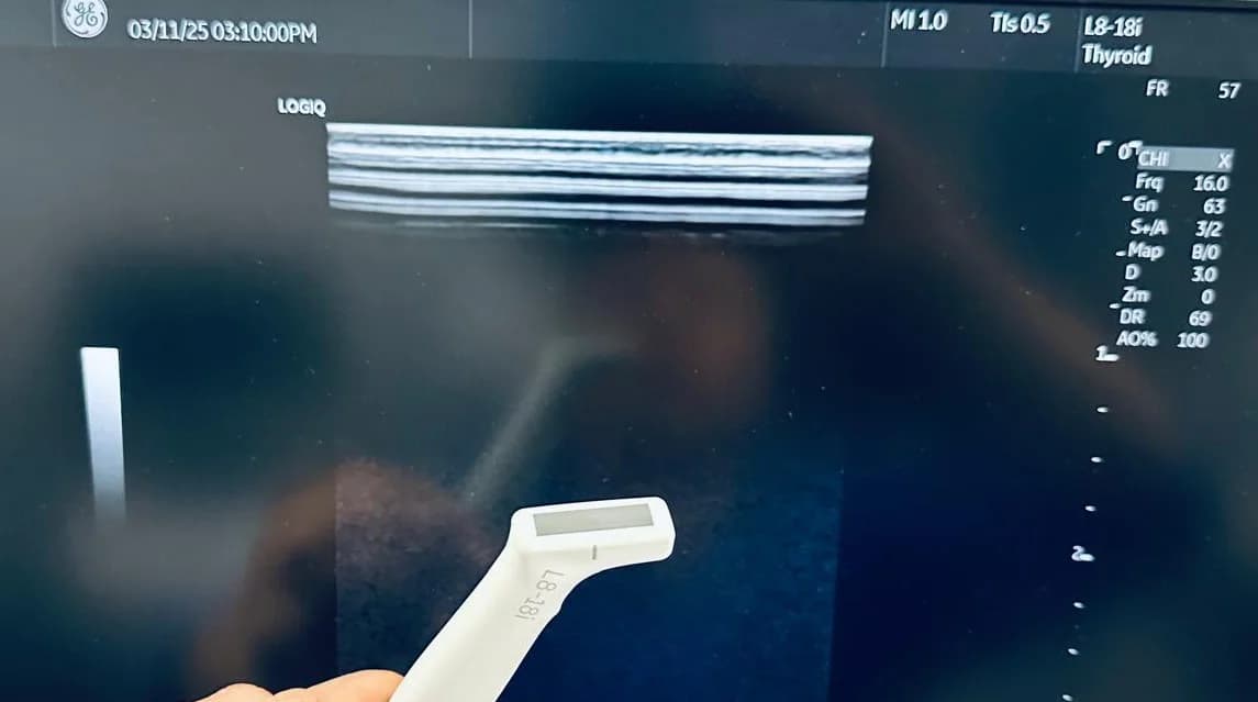 GE L8-18i-D Linear Probe