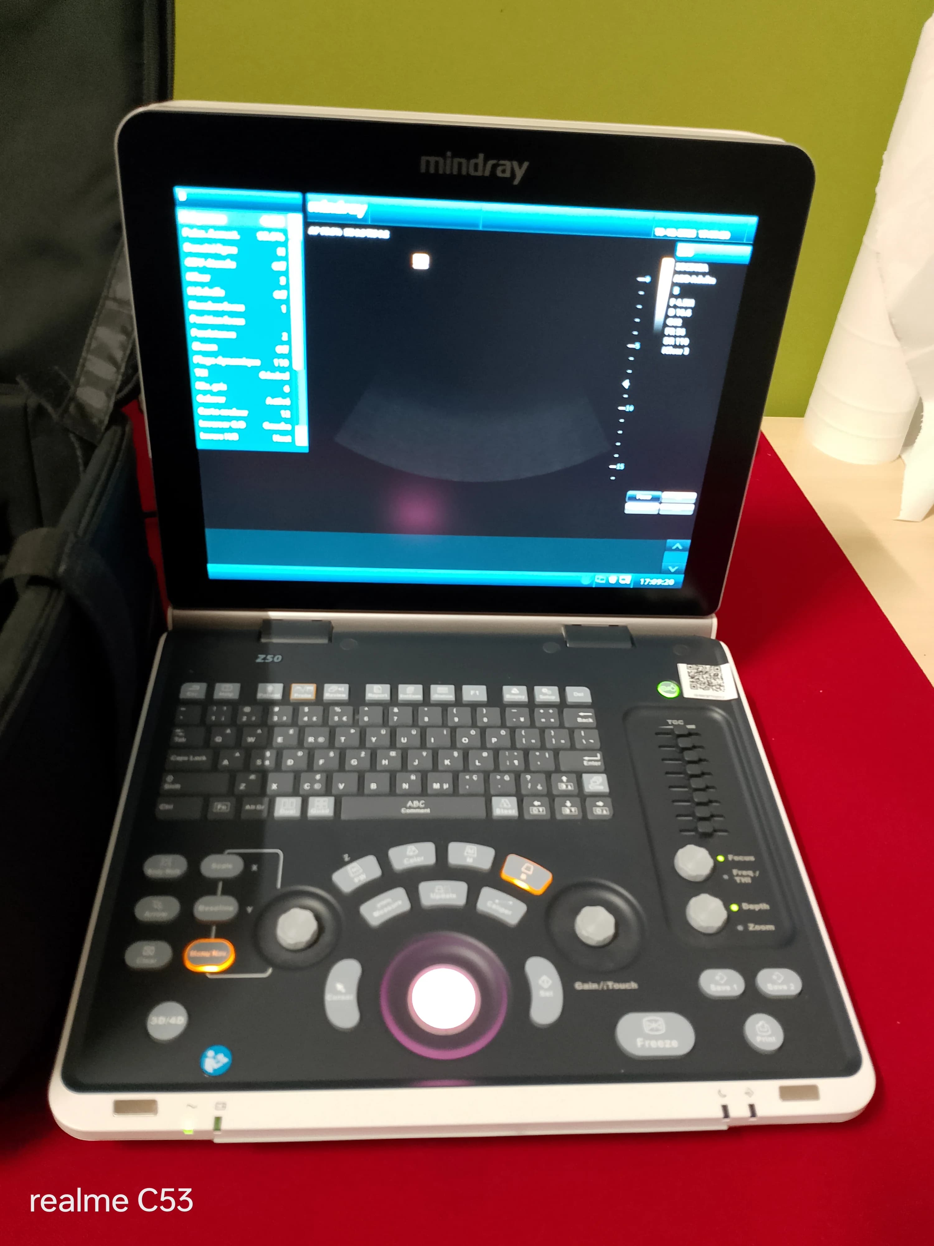 MINDRAY Z50 Ultrasound Machine