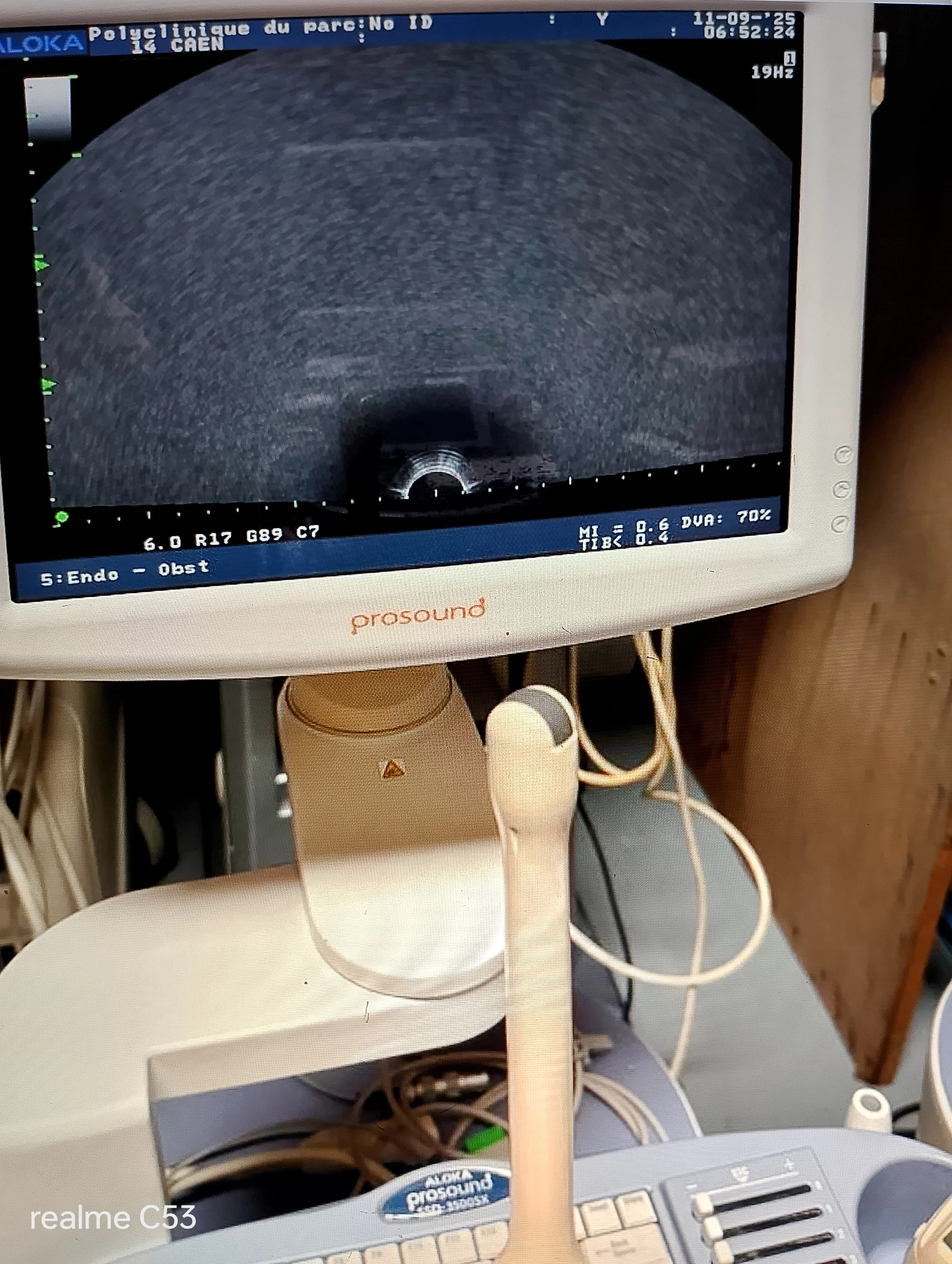 ALOKA SSD-3500 Ultrasound Machine