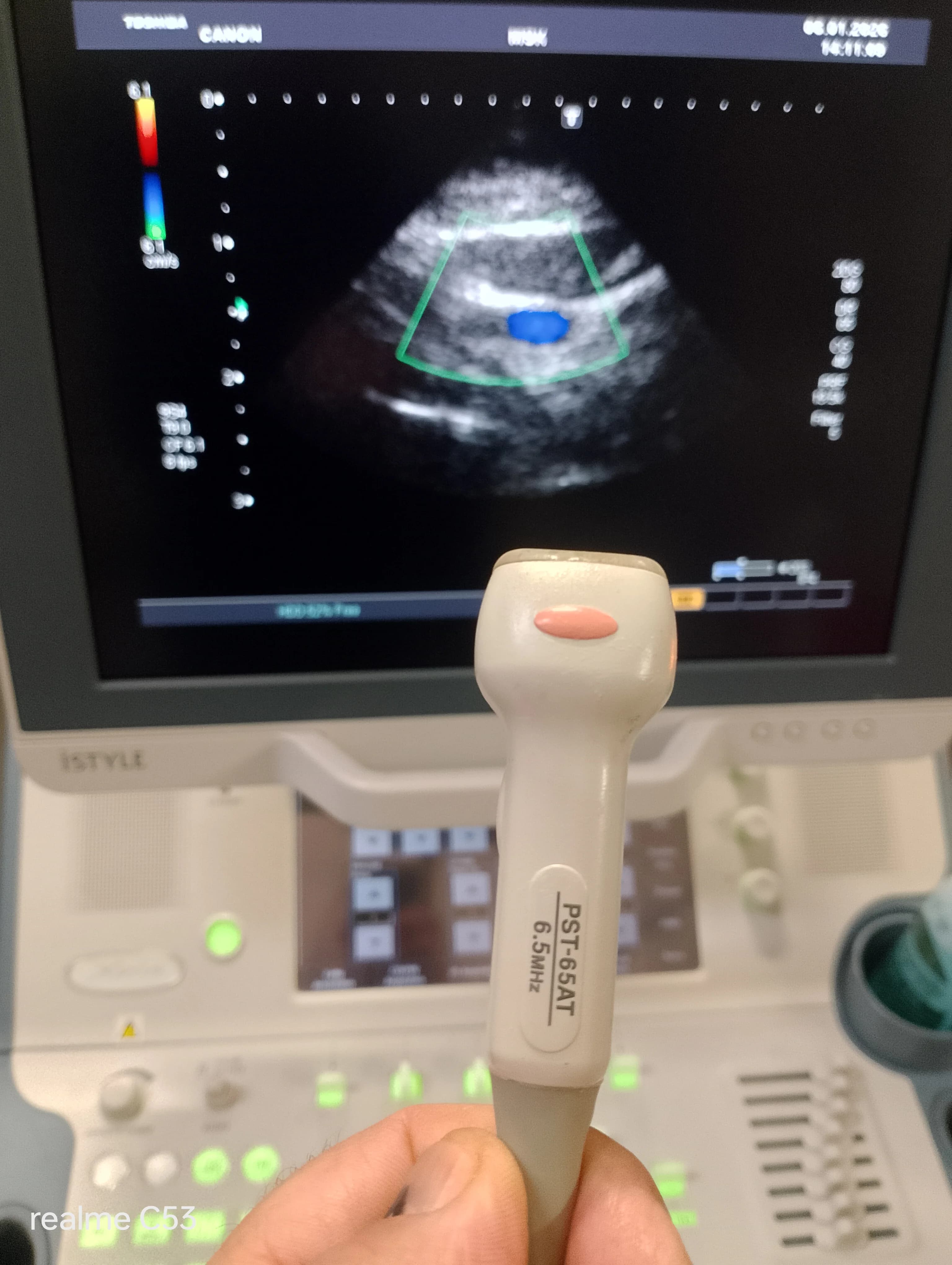 TOSHIBA PST-65AT Cardiac Probe