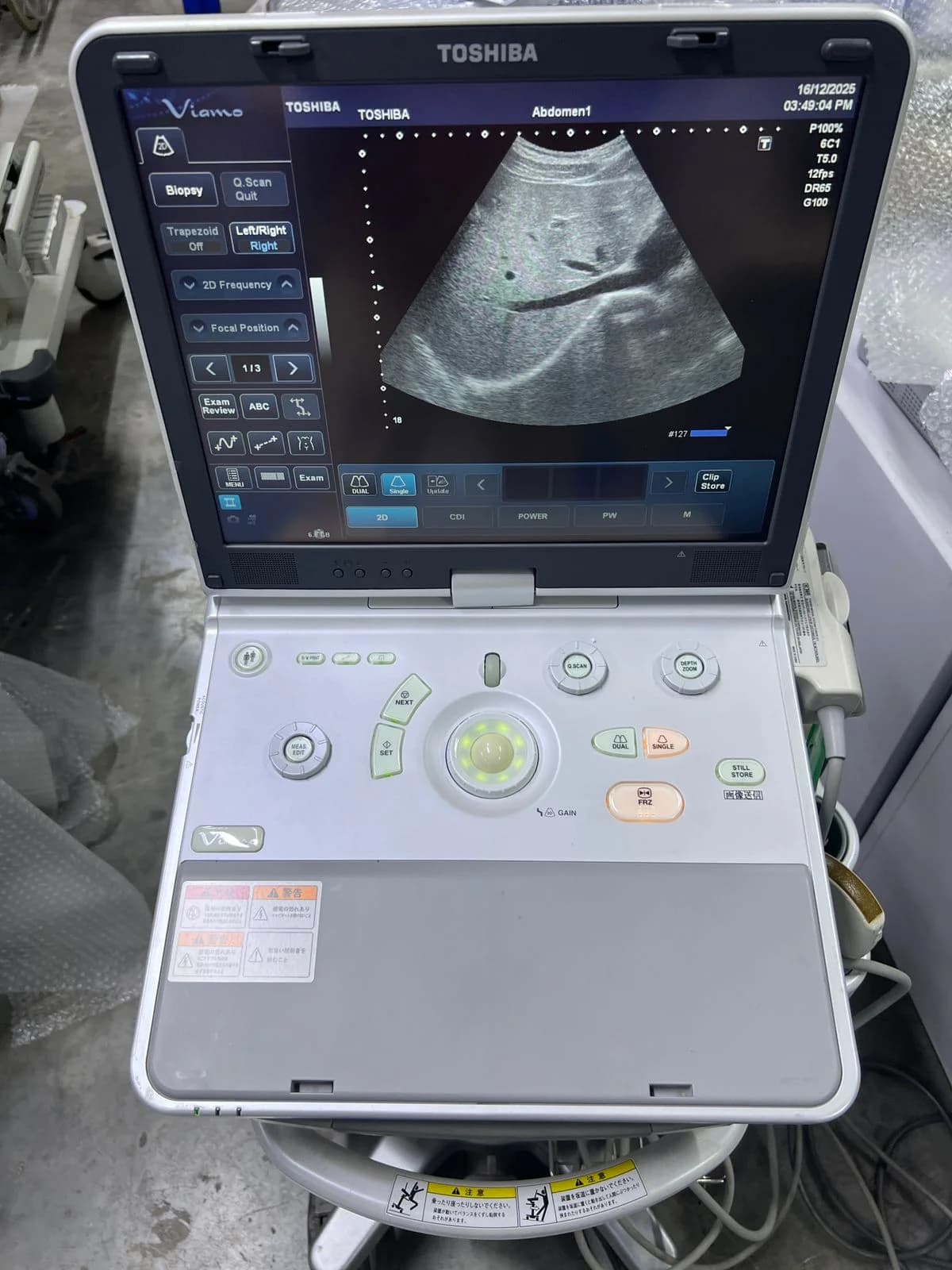 TOSHIBA Viamo (SSA-640A) Ultrasound Machine