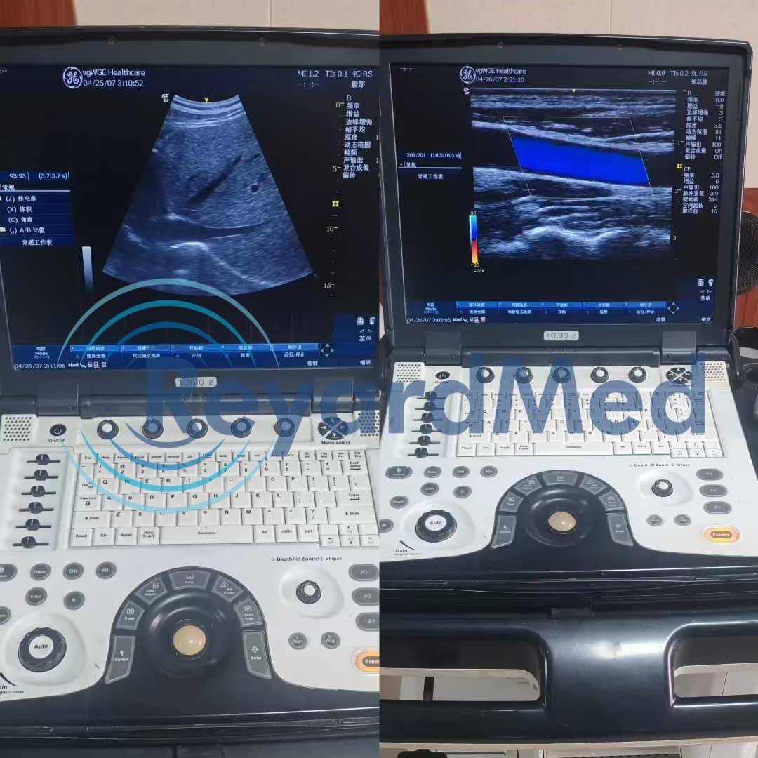 GE Logiq E Ultrasound Machine