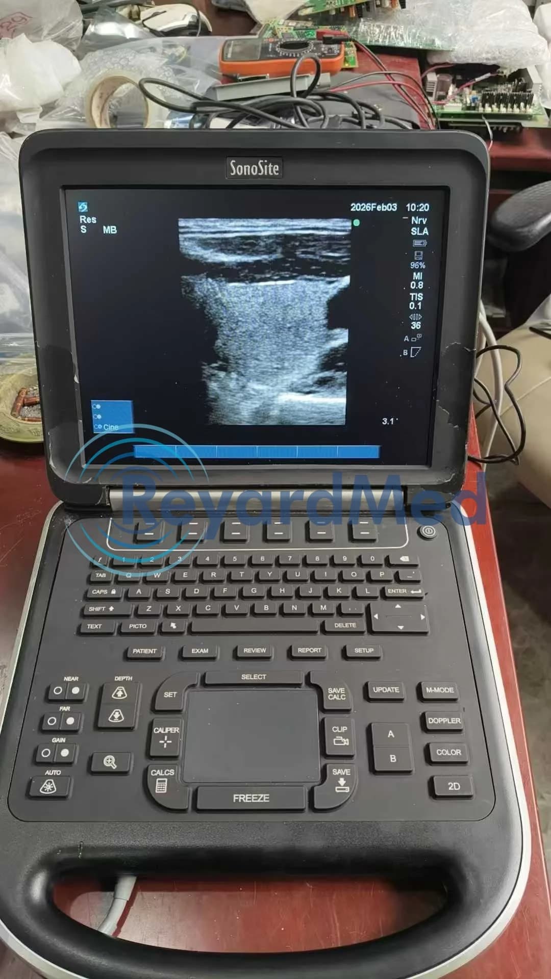 SONOSITE Edge Ultrasound Machine
