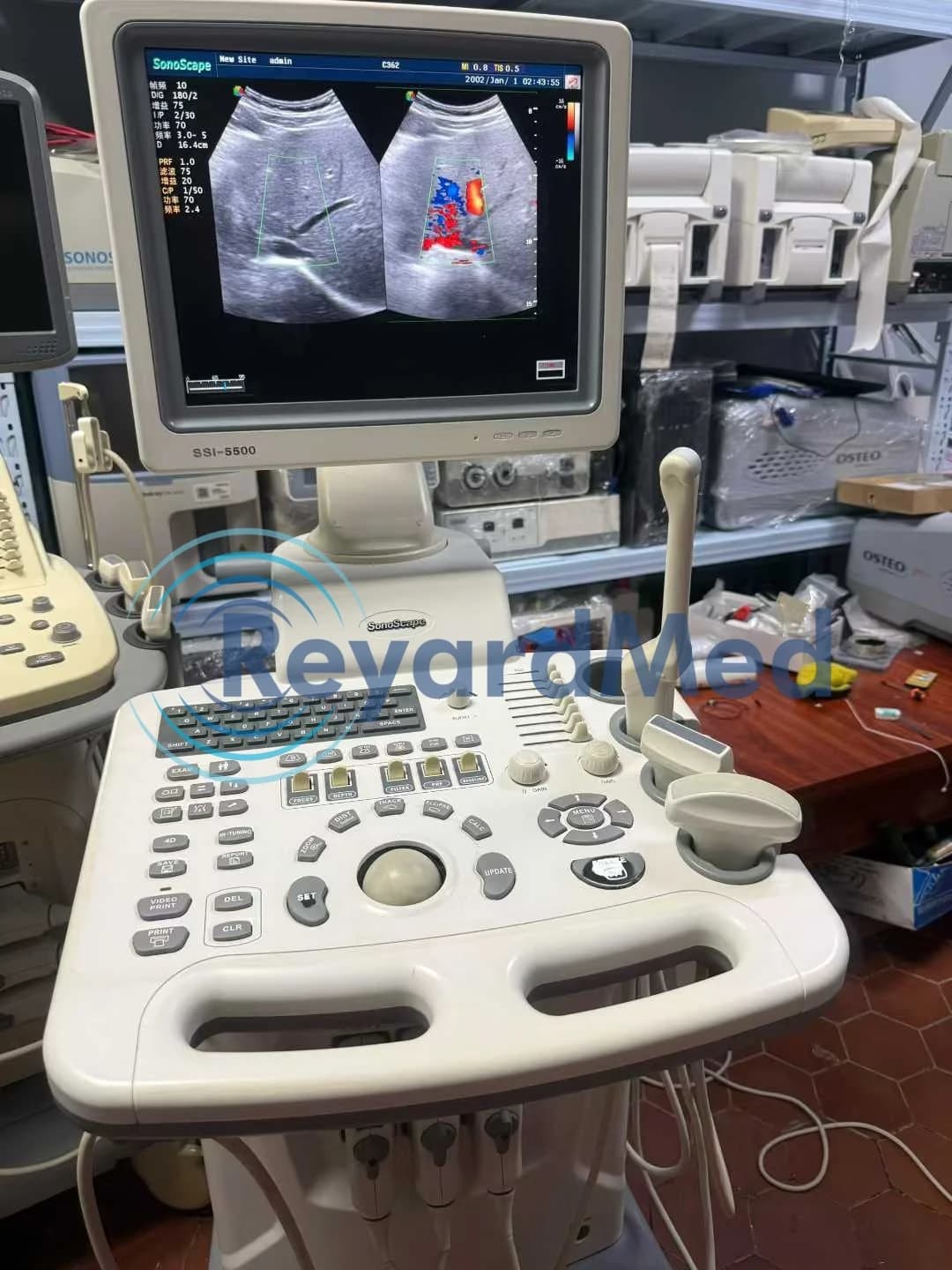 SONOSCAPE SSI-5500 Ultrasound Machine