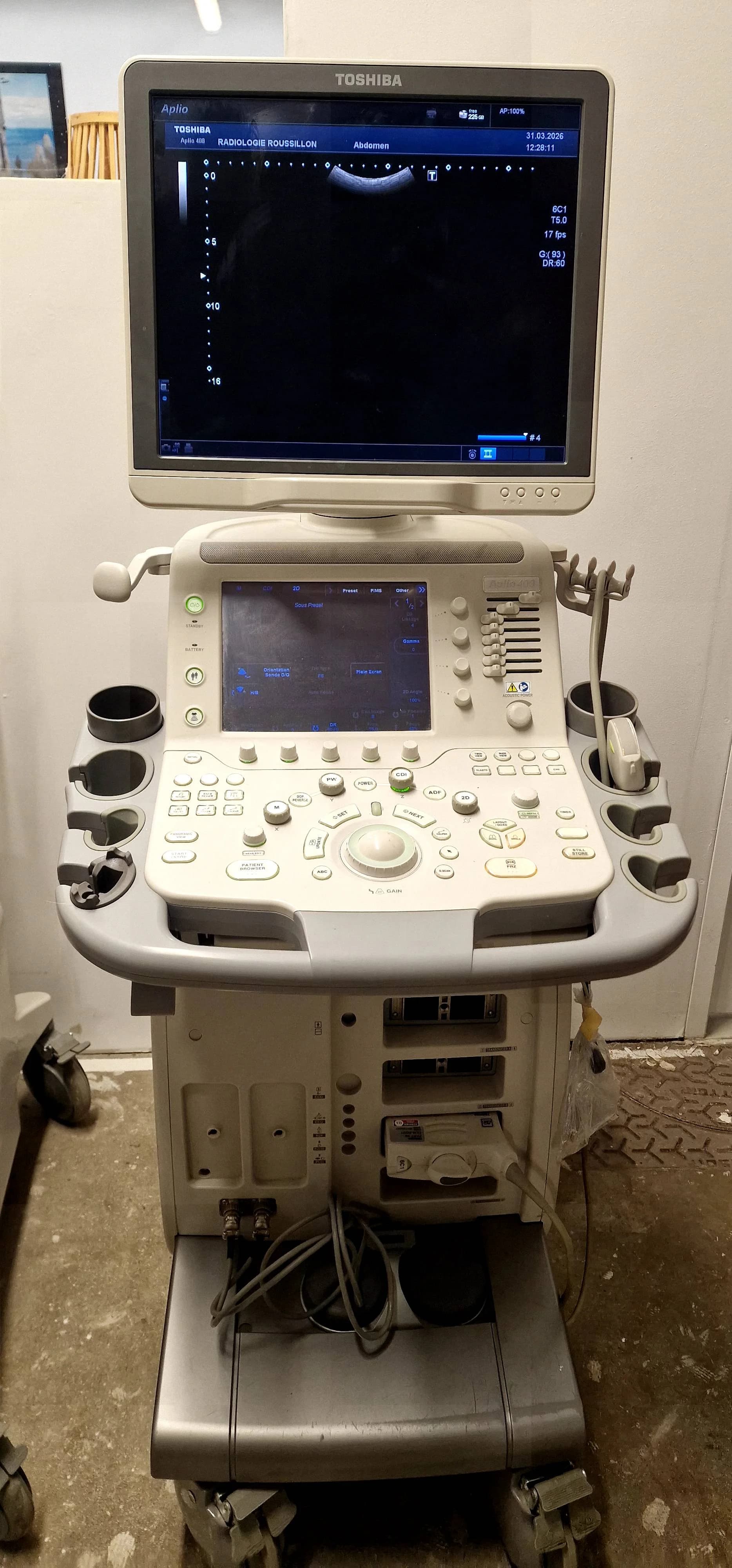 TOSHIBA Aplio 400 (TUS-A400) Ultrasound Machine