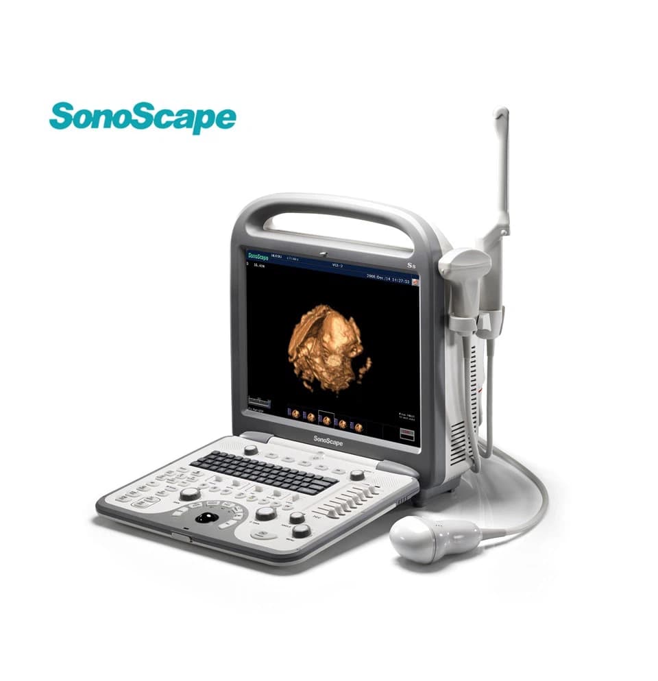 SONOSCAPE S8 Ultrasound Machine