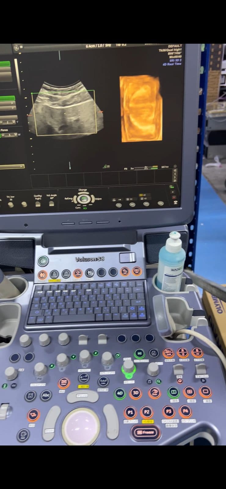 GE Voluson S8 Ultrasound Machine