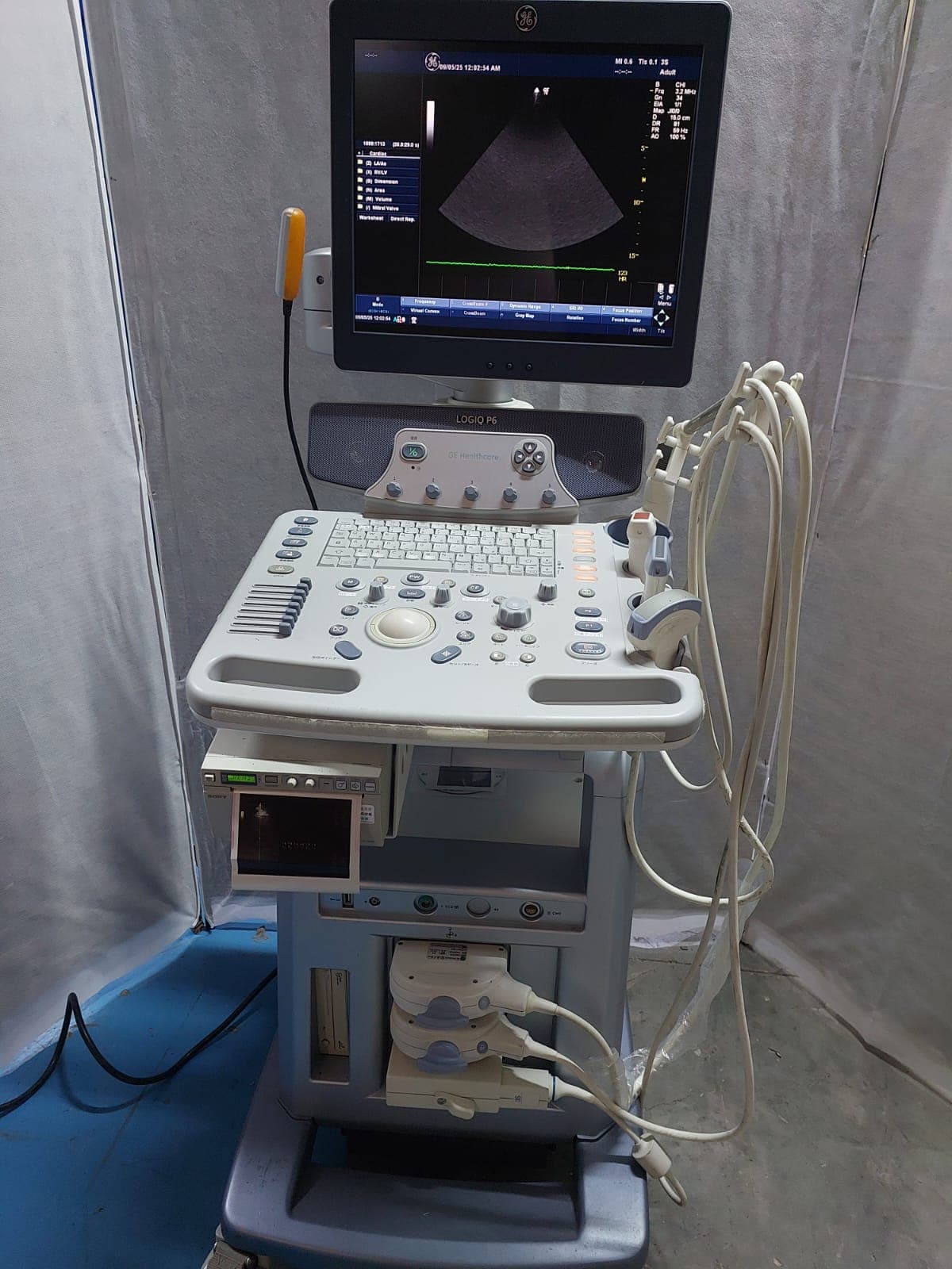 GE Logiq P6 Ultrasound Machine