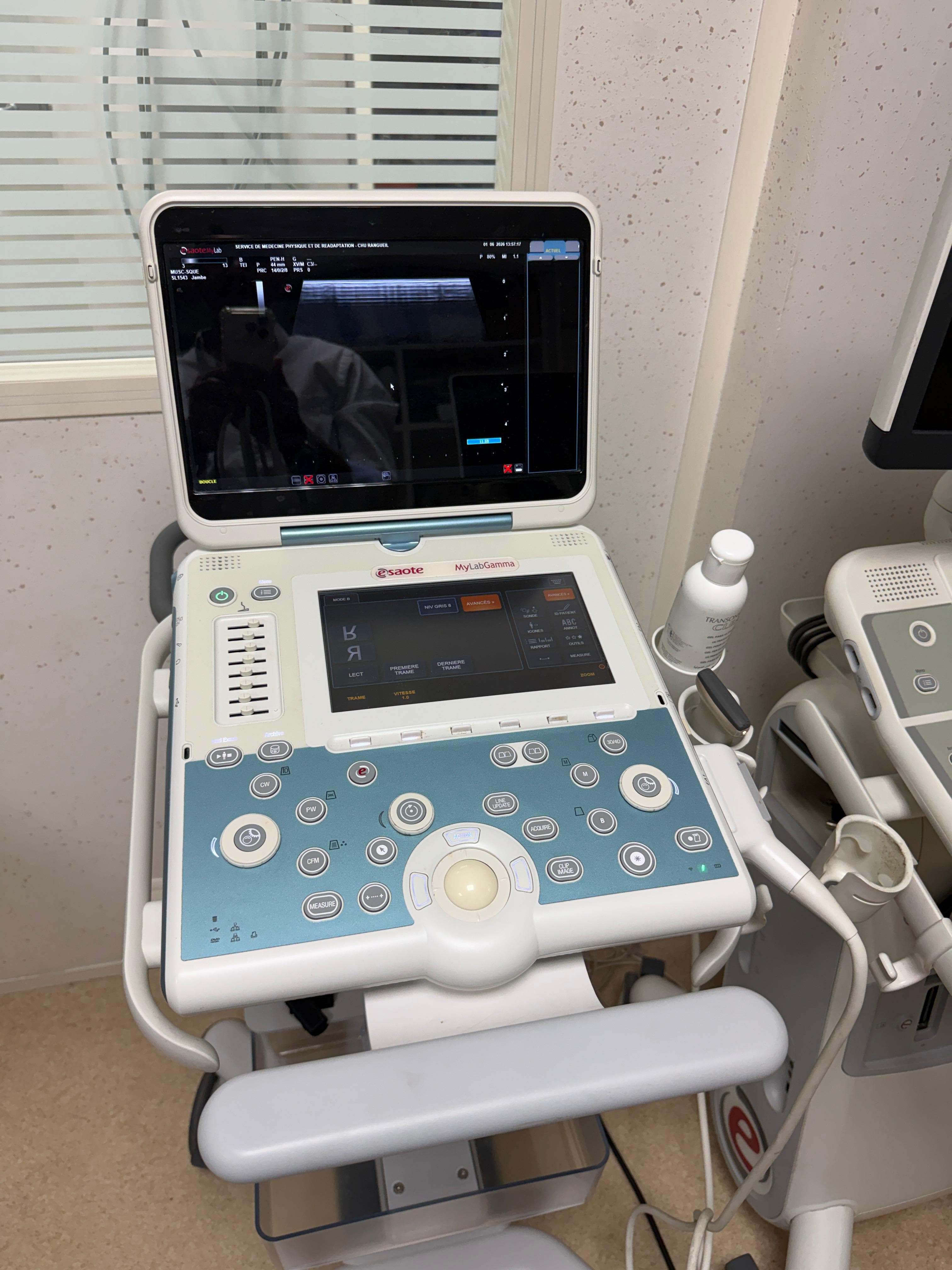 ESAOTE MyLab Gamma Ultrasound Machine