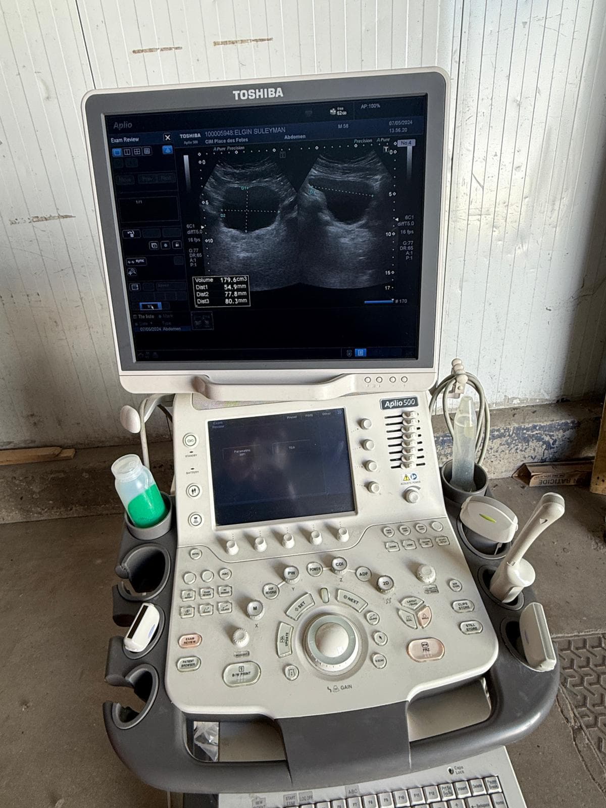 TOSHIBA Aplio 500 (TUS-A500) Ultrasound Machine
