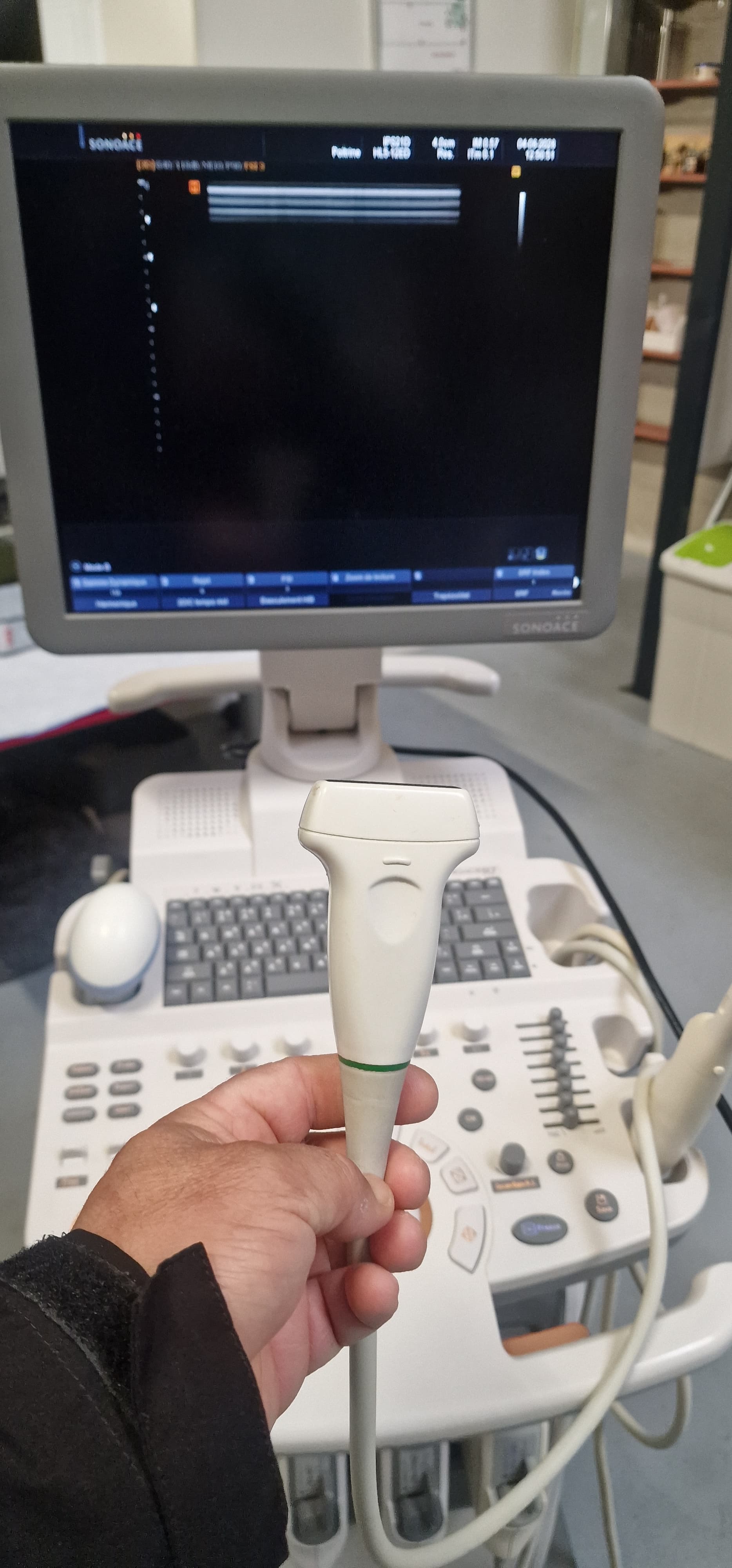 SAMSUNG SonoAce R7 Ultrasound Machine