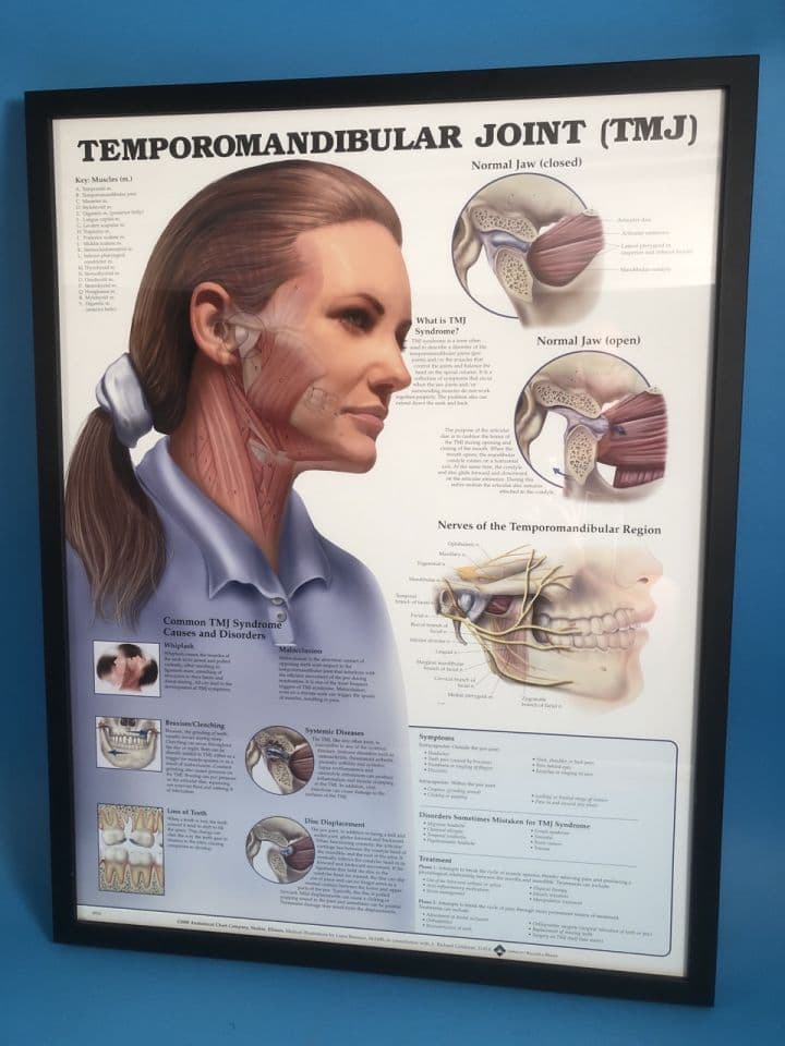 For Sale ANATOMICAL CHART CO. 9932 Temporomandibular Joint Poster