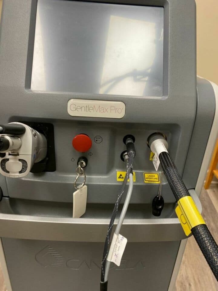 For Sale CANDELA GENTLEMAX PRO Laser - Alexandrite