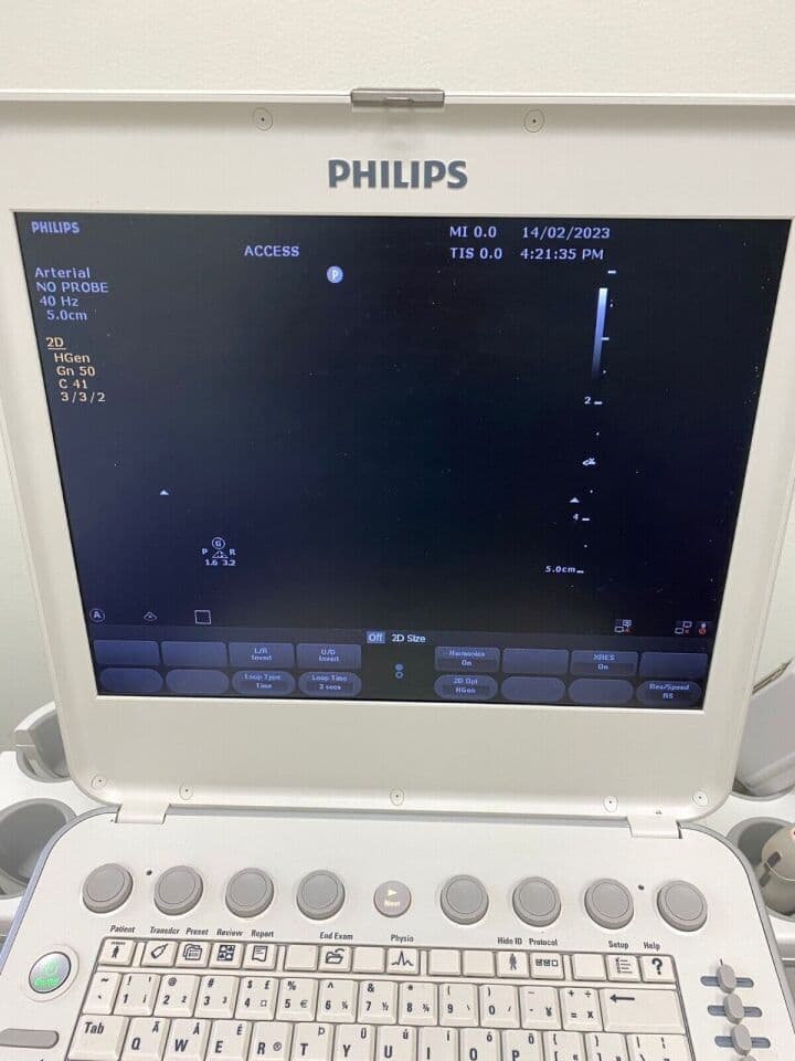 For Sale PHILIPS CX50 Cardiac Ultrasound
