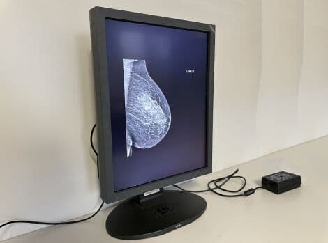 For Sale TOTOKU ME315L - MDL2105A X-Ray Monitor