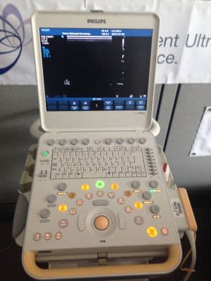 For Sale PHILIPS CX50 Cardiac - Vascular Ultrasound