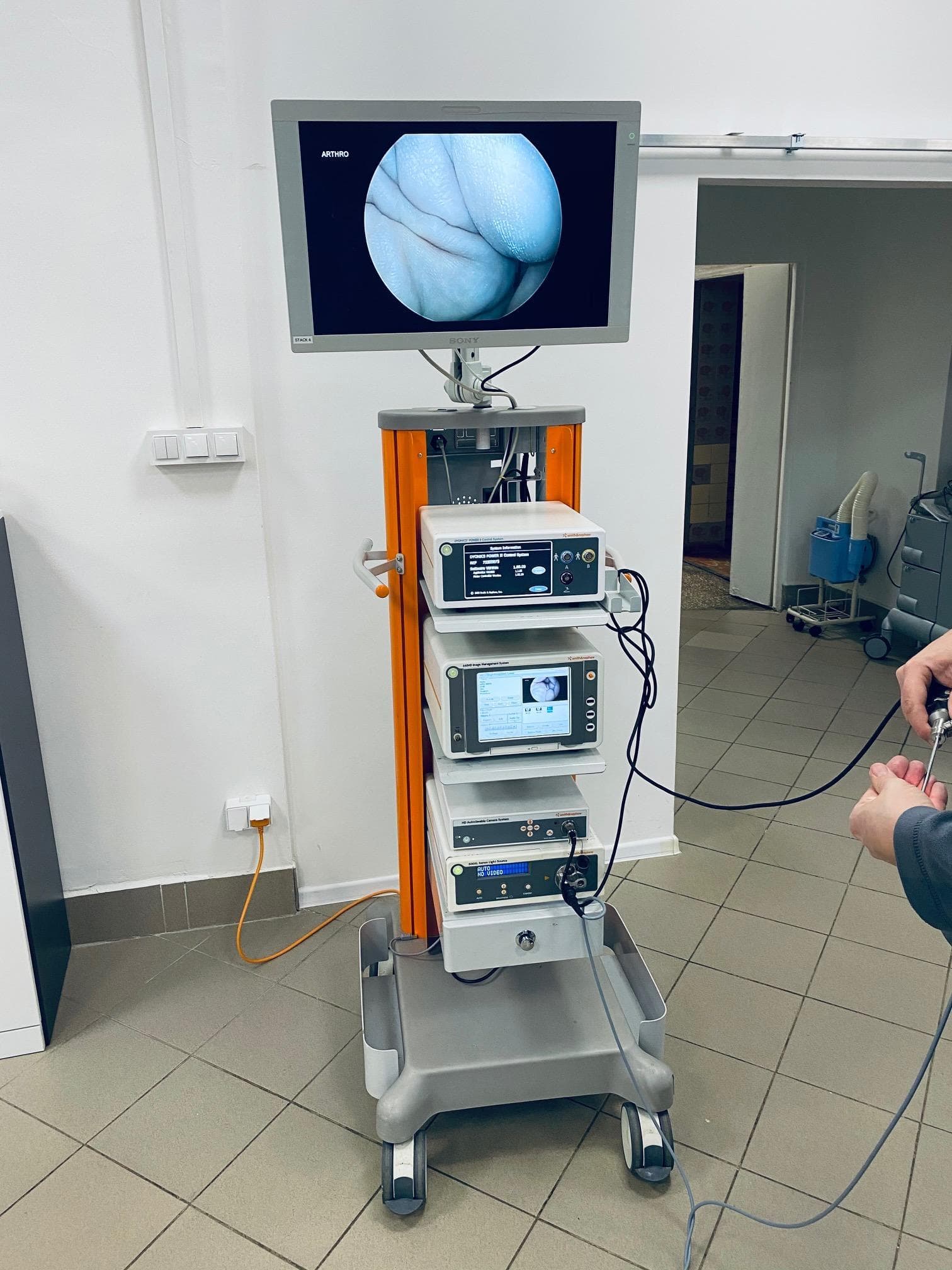 SMITH & NEPHEW 660 HD Endoscopy System