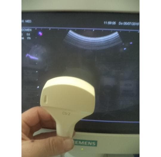 SIEMENS C5-2 Convex Probe