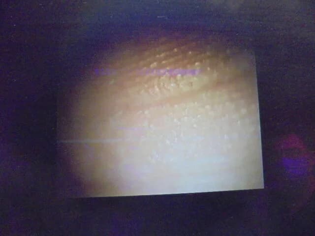 RICHARD WOLF Endocam Logic HD Endoscopy System