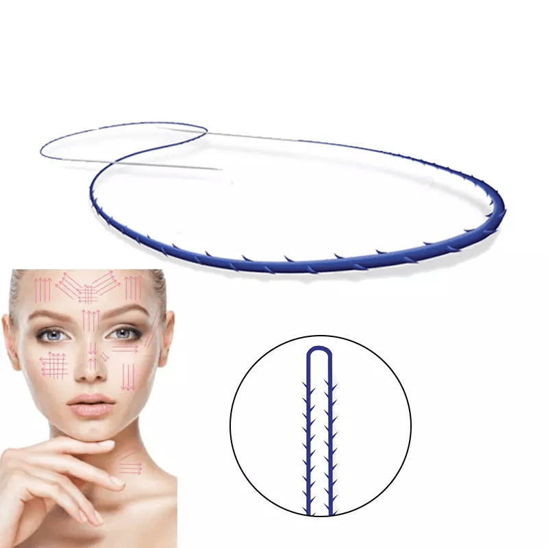 TRUGLYDE FAST 2.0 / 3.0 Suture thread