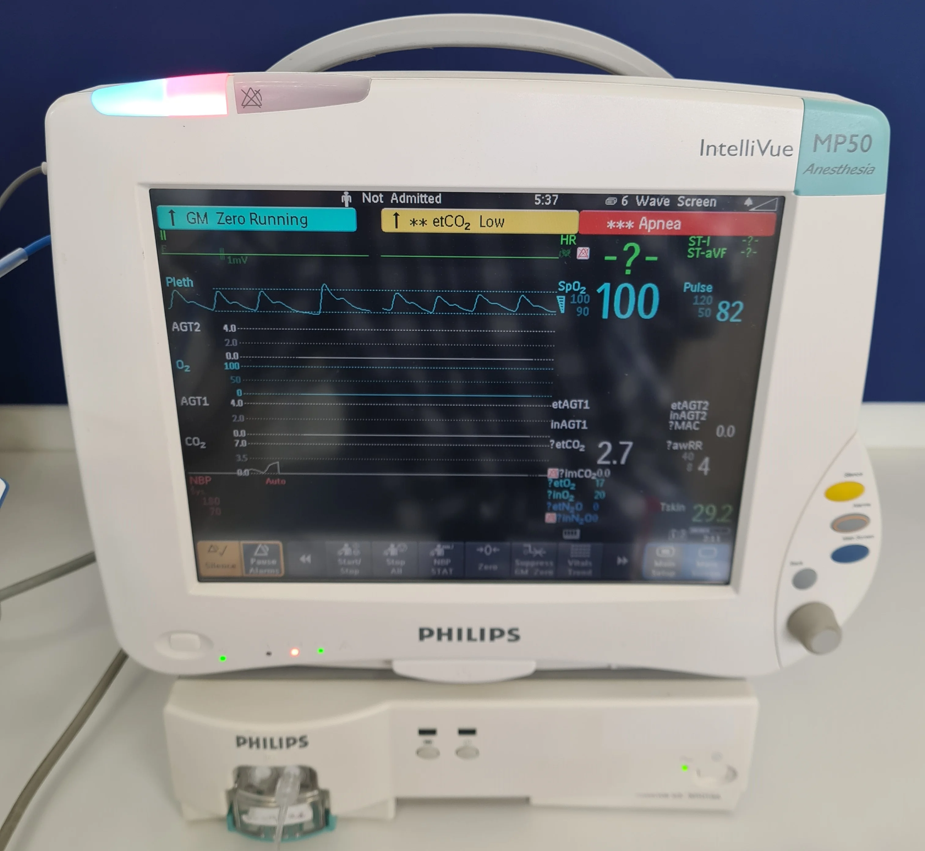 PHILIPS IntelliVue MP50 EKG monitor