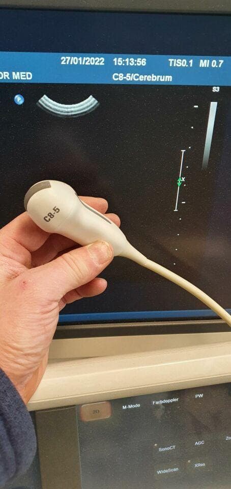 PHILIPS C8-5 Micro Convex Probe