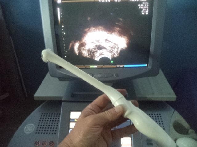 GE IC5-9H Endocavity probe