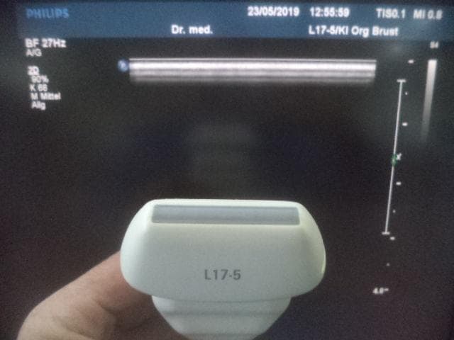 PHILIPS L17-5 Linear Probe