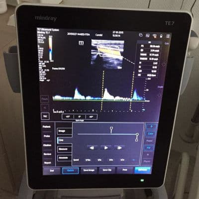For Sale MINDRAY TE7 Touch Enabled Shared Service Ultrasound