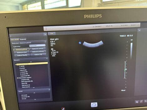 PHILIPS C5-1 Convex Probe