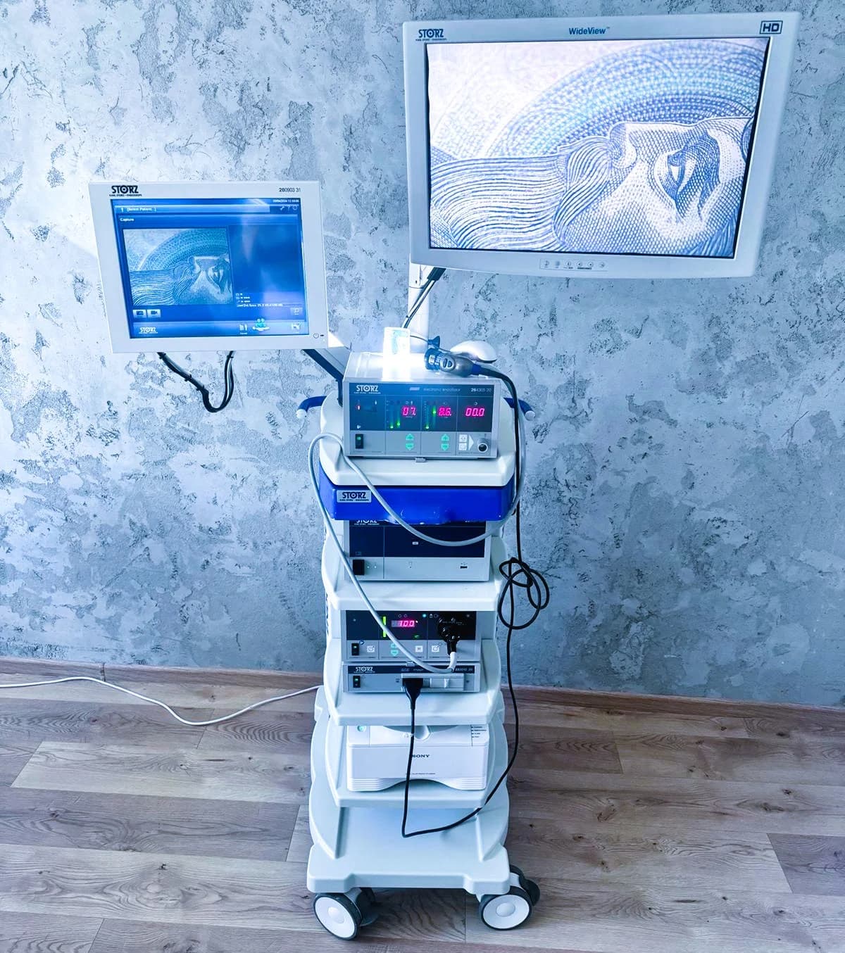 KARL STORZ Image 1 HUB HD Endoscopy System
