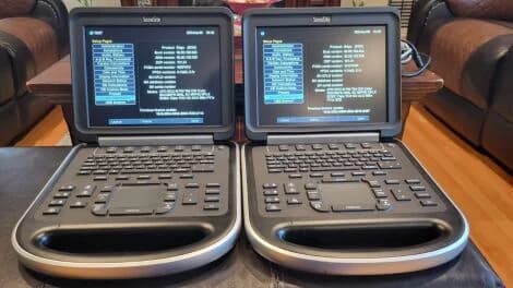 SONOSITE Edge Ultrasound Machine