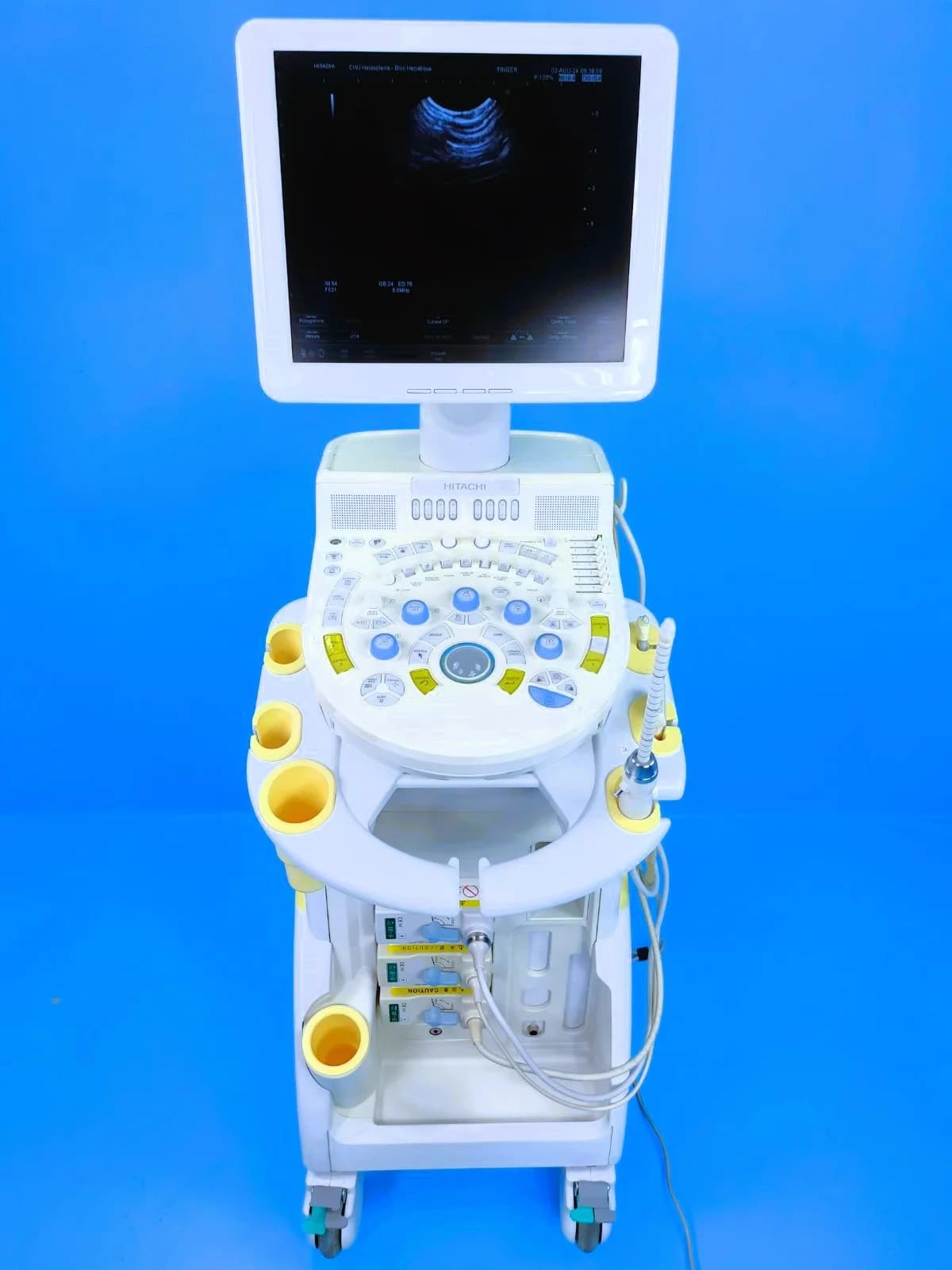 HITACHI HI VISION Avius Ultrasound Machine