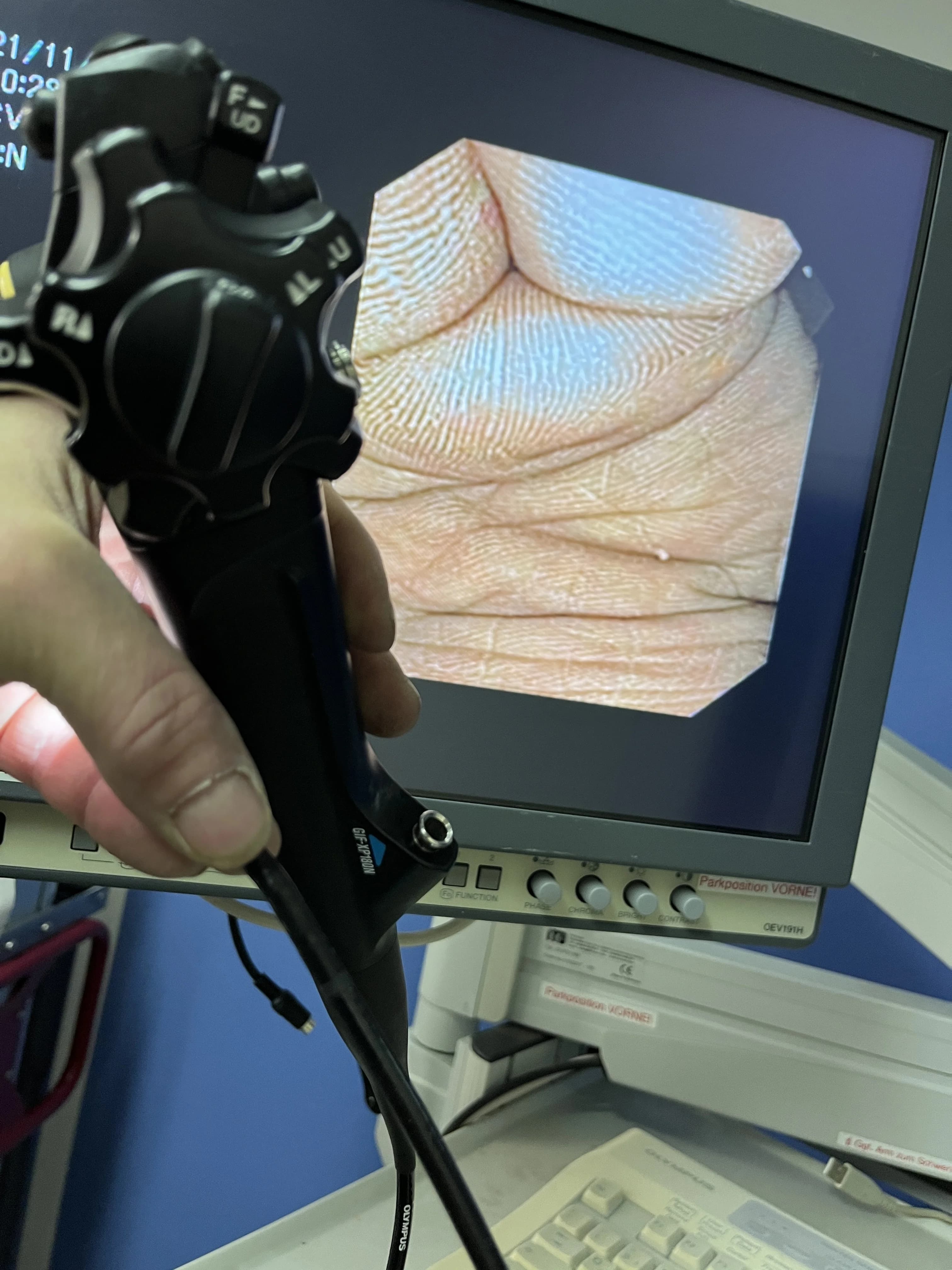 OLYMPUS GIF-XP180N Video gastroscope